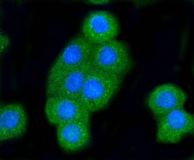 Anti-BAK1 Antibody (2V22)
