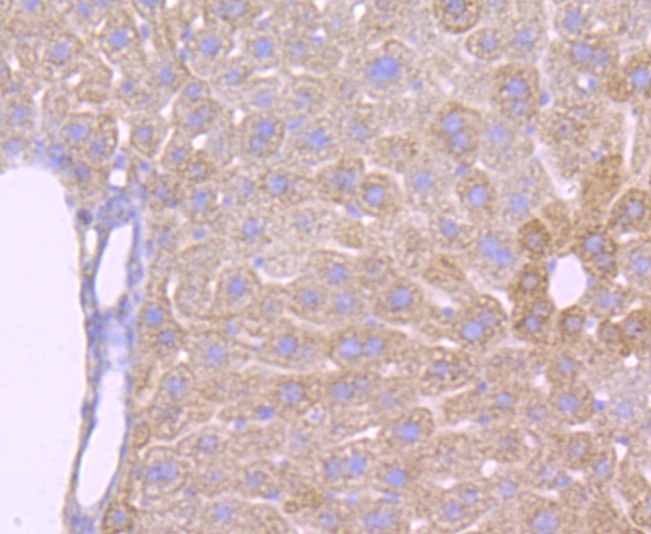 Anti-ATP5B Antibody (8V910)