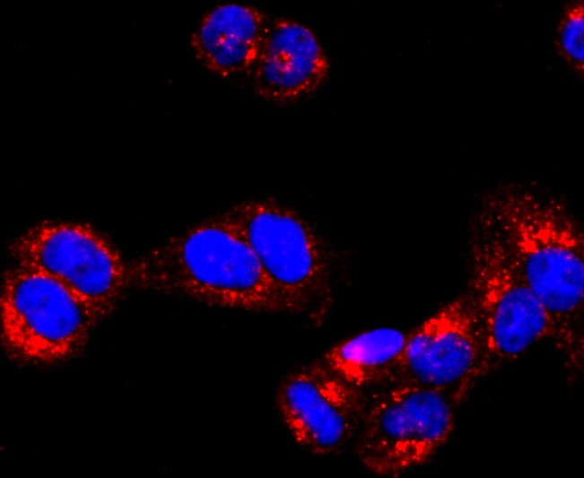 Anti-ATP5B Antibody (8V910)