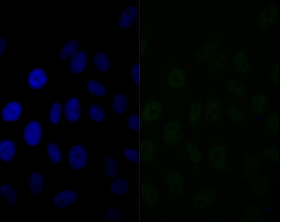 Anti-BAF57 Antibody (2O20)