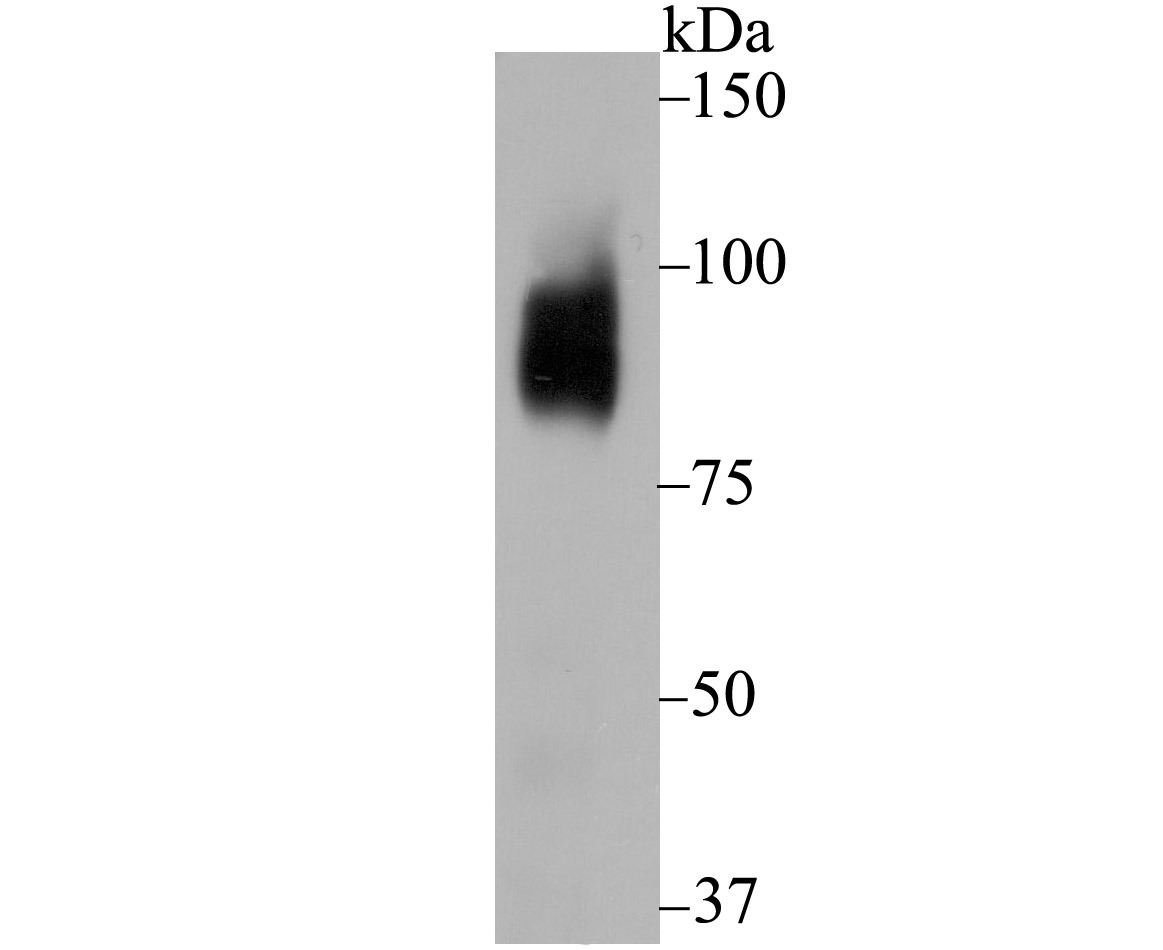 Anti-BCL6 Antibody (4B197)