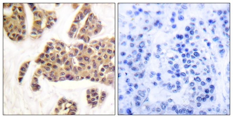 Anti-Phospho-Bad (Ser91, 128) Polyclonal Antibody
