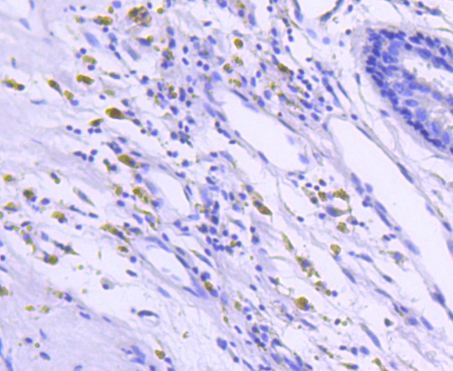 Anti-BRAF Antibody (7W36)