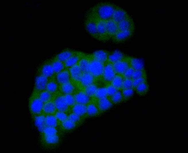 Anti-CaMK2 Antibody (2O871)