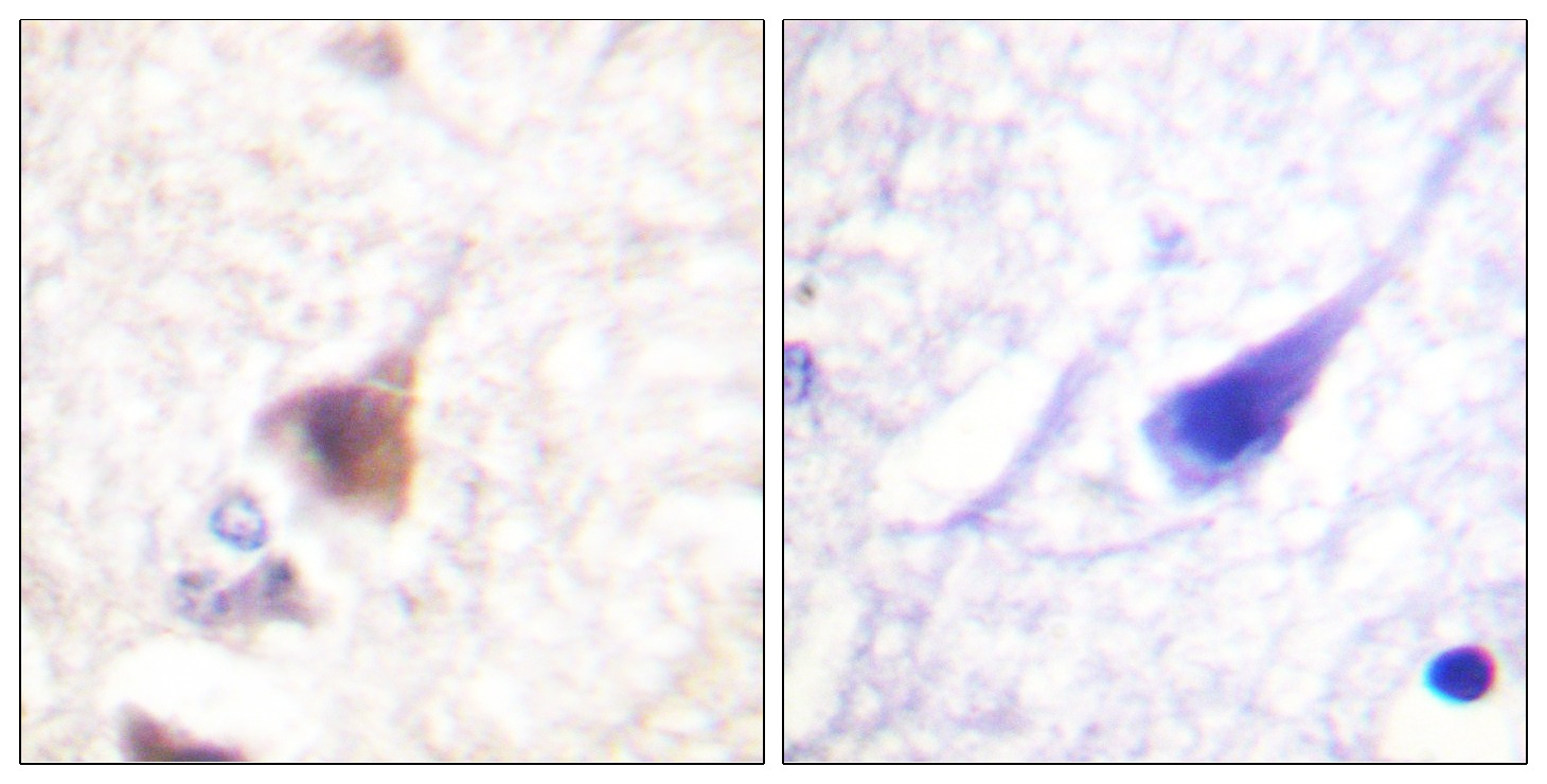 Anti-Phospho-CAMKIV (Thr196, 200) Polyclonal Antibody