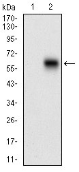 Anti-CAMK2G Antibody (8A304)