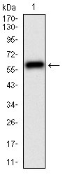 Anti-CAMK2G Antibody (8A304)