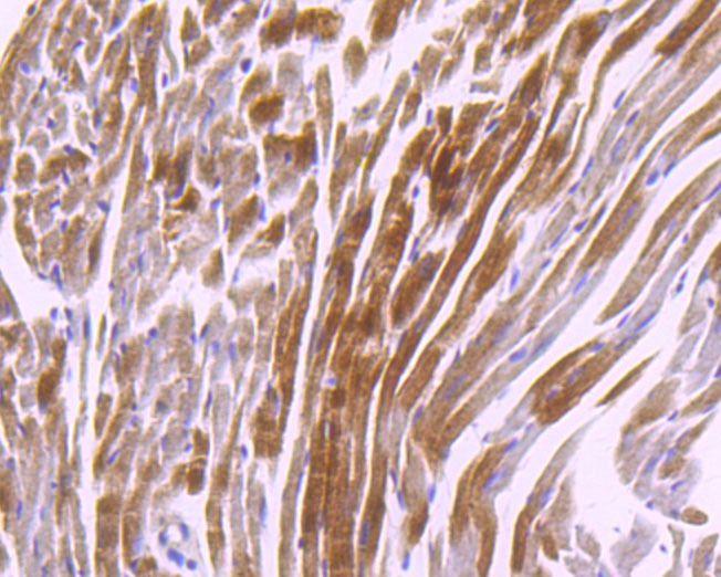 Anti-CAMK2D Antibody (7Z493)