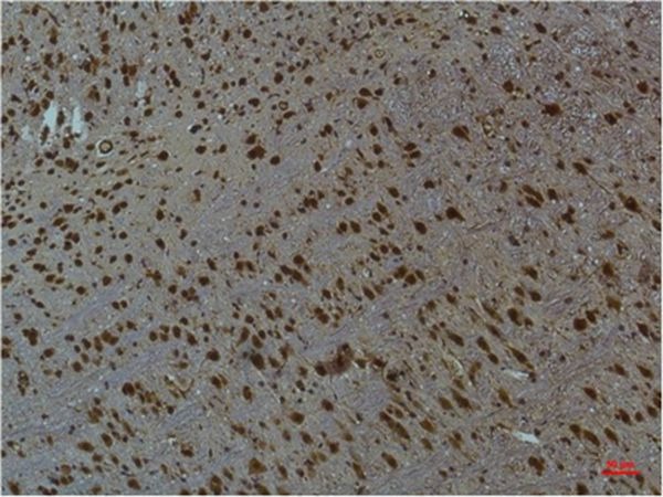 Anti-Phospho-CAMKII beta/gamma/delta (Thr287) Antibody (8M391)