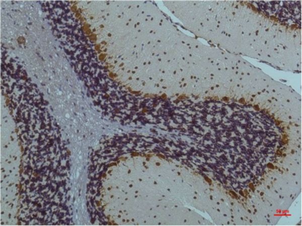 Anti-Phospho-CAMKII beta/gamma/delta (Thr287) Antibody (8M391)