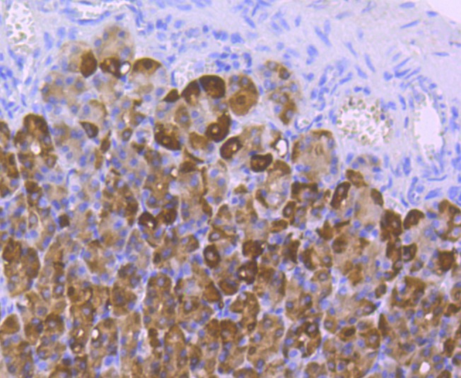 Anti-Carbonic Anhydrase 2 Antibody (5N337)