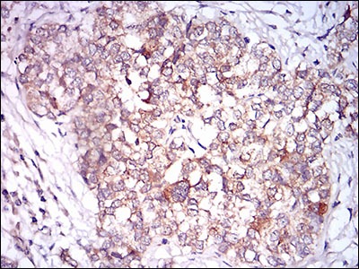 Anti-CAMK2G Antibody (8A304)