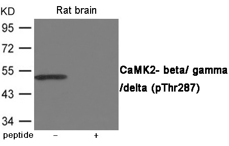 Anti-Phospho-CAMKII beta/gamma/delta (Thr287) Polyclonal Antibody