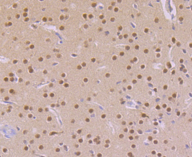 Anti-CAMKIV Antibody (5K734)