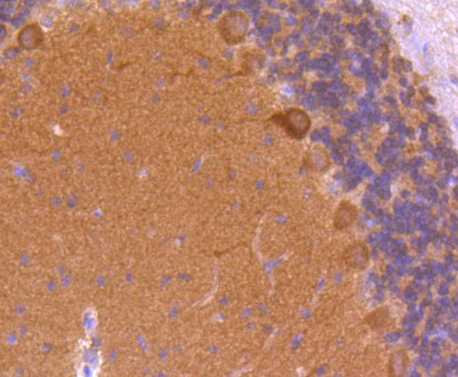 Anti-CaMK2 Antibody (2O871)