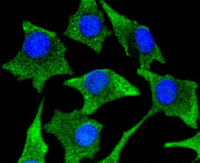 Anti-CaMK2 Antibody (2O871)