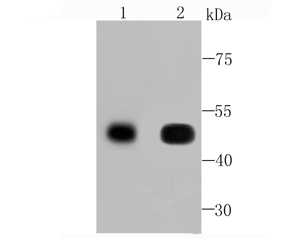 Anti-CAMK2D Antibody (7Z493)