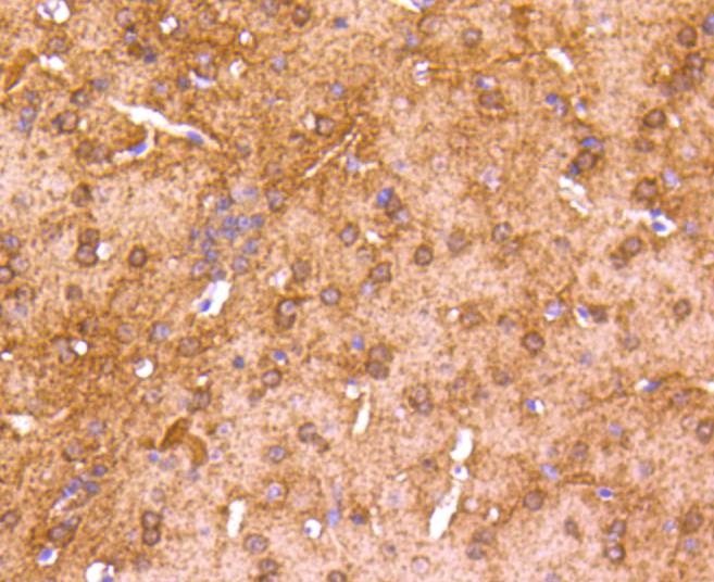 Anti-CaMK2 Antibody (2O871)
