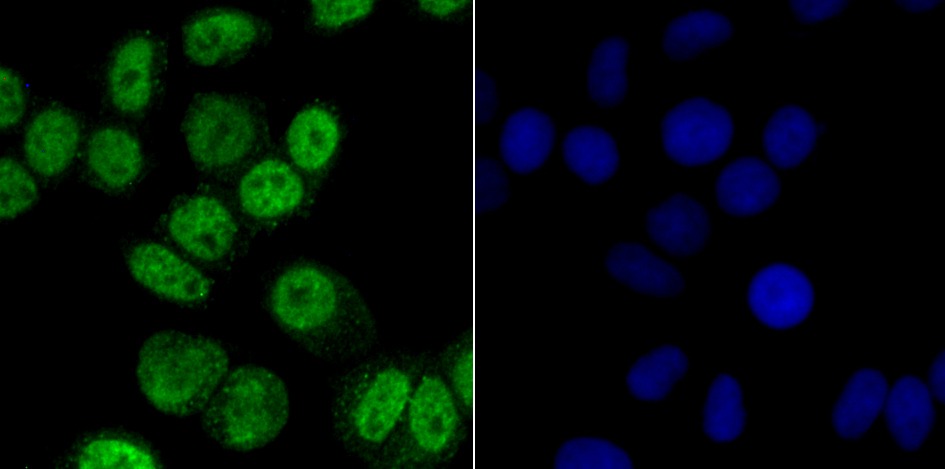 Anti-CAMKIV Antibody (5K734)