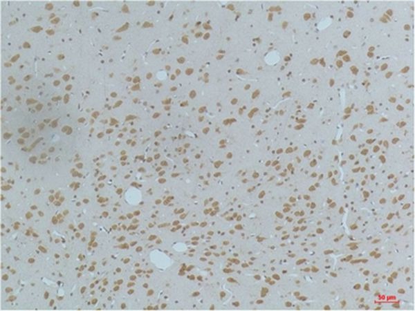 Anti-Phospho-CAMKII beta/gamma/delta (Thr287) Antibody (7V57)