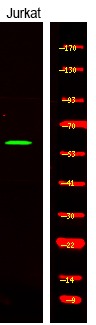 Anti-Phospho-CAMKK1/2 (Ser458/495) Polyclonal Antibody
