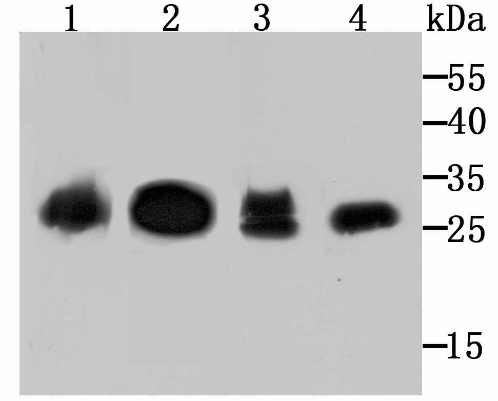 Anti-Carbonic Anhydrase 2 Antibody (5N337)