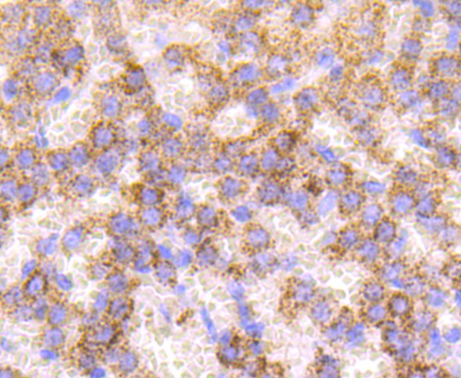 Anti-Catalase/CAT Antibody (3Q335)