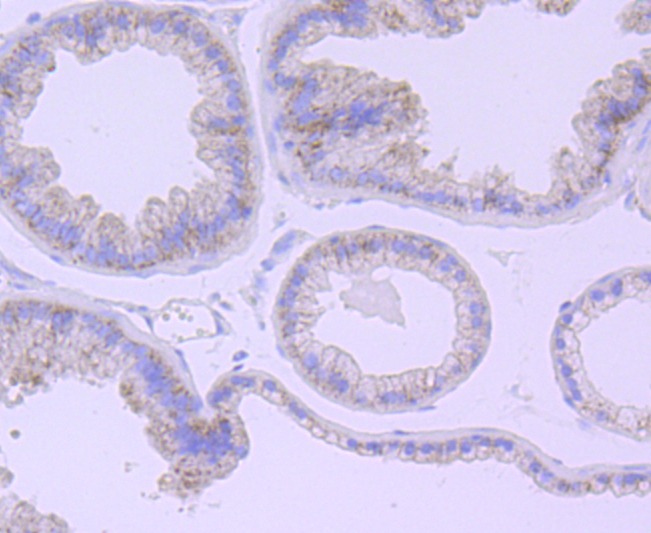 Anti-Catalase/CAT Antibody (3Q335)