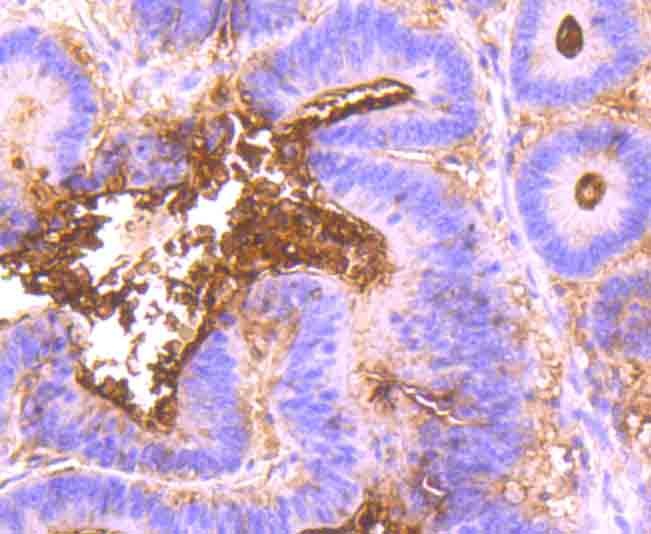 Anti-CEACAM5 Antibody (1I250)