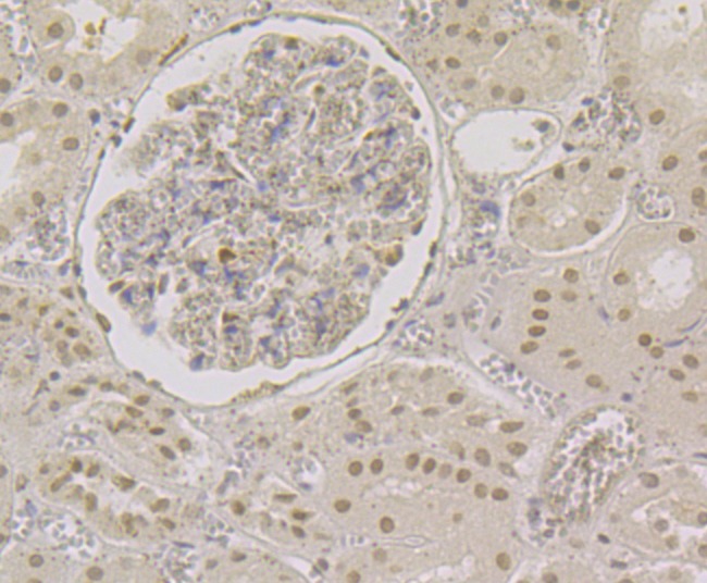 Anti-CBFB Antibody (1I567)