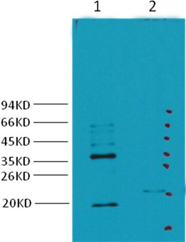 Anti-Carbonic Anhydrase 9 Antibody (7H302)