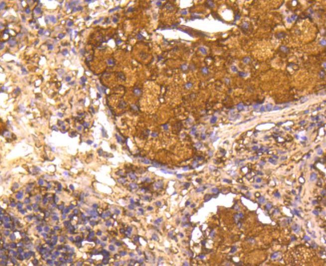 Anti-Caspase-1 Antibody (4V493)