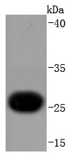 Anti-TNNI3 Antibody (8F759)