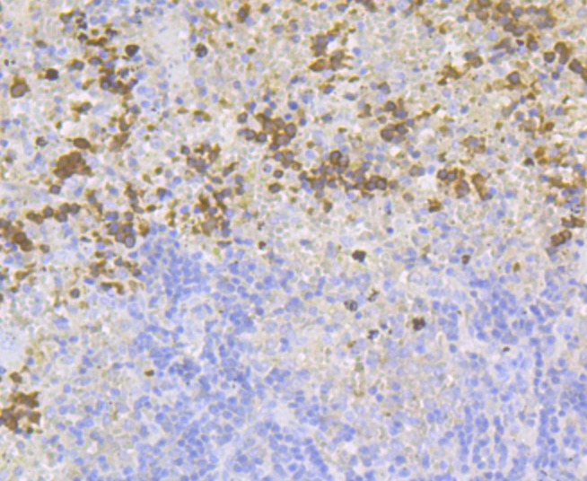 Anti-Carbonic Anhydrase 1 Antibody (2E643)