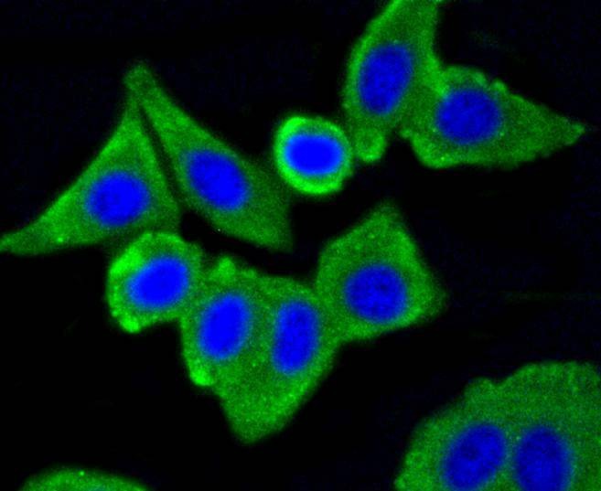Anti-CAV1 Antibody (1U205)