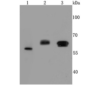 Anti-Catalase/CAT Antibody (3Q335)