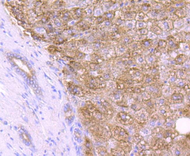 Anti-Catalase/CAT Antibody (3Q335)