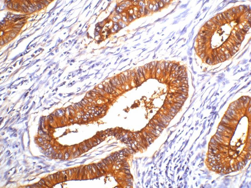 Anti-Carcinoembryonic Antigen Antibody (3V54)