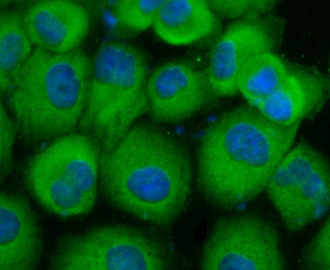 Anti-CEACAM5 Antibody (1I250)