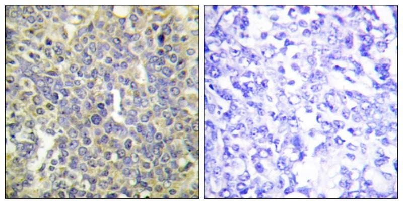 Anti-Phospho-CASP9 (Thr125) Polyclonal Antibody 2