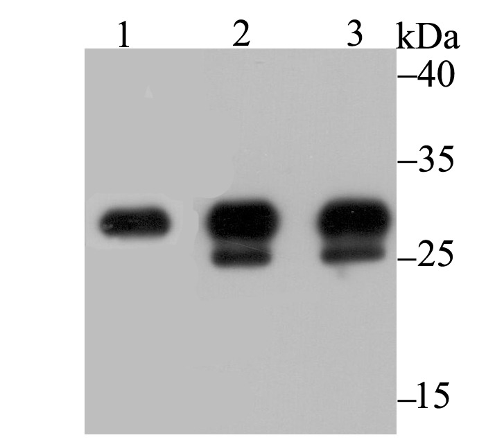 Anti-Carbonic Anhydrase 1 Antibody (2E643)