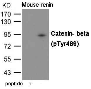 Anti-Phospho-CTNNB1 (Tyr489) Polyclonal Antibody 2