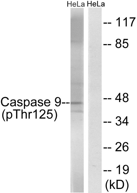 Anti-Phospho-CASP9 (Thr125) Polyclonal Antibody 2