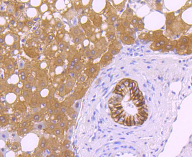 Anti-Carbonic Anhydrase 9 Antibody (8K855)
