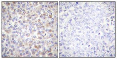 Anti-Phospho-AMPKα1/2 (Thr183/172) Polyclonal Antibody 2