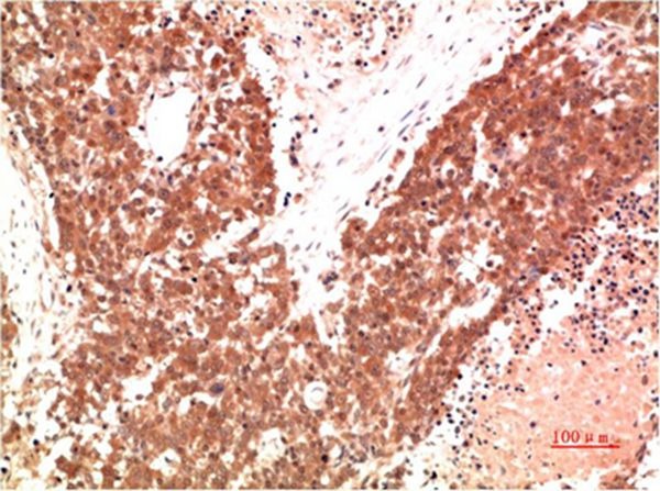 Anti-AMPK α1 Antibody (6X568)