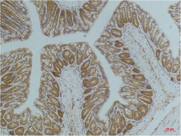 Anti-AMPK α1 Antibody (5Z479)