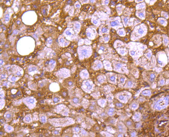 Anti-Apolipo A-I/APOA1 Antibody (2Q549)