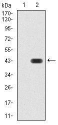 Anti-KDM1B Antibody (3V868)