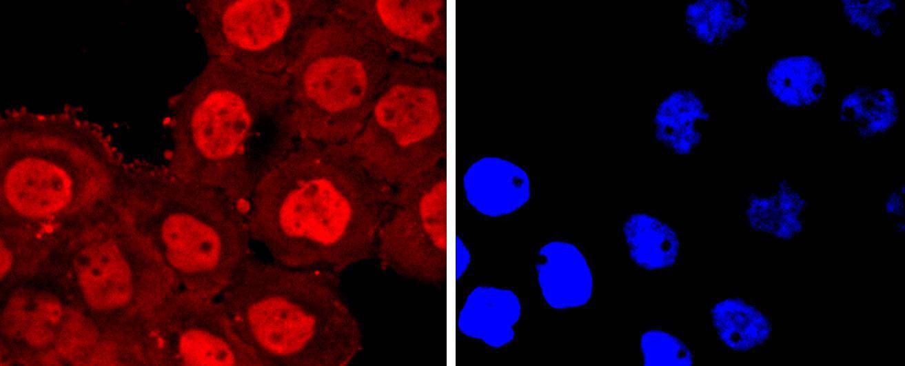 Anti-Annexin V/ANXA5 Antibody (2Q736)